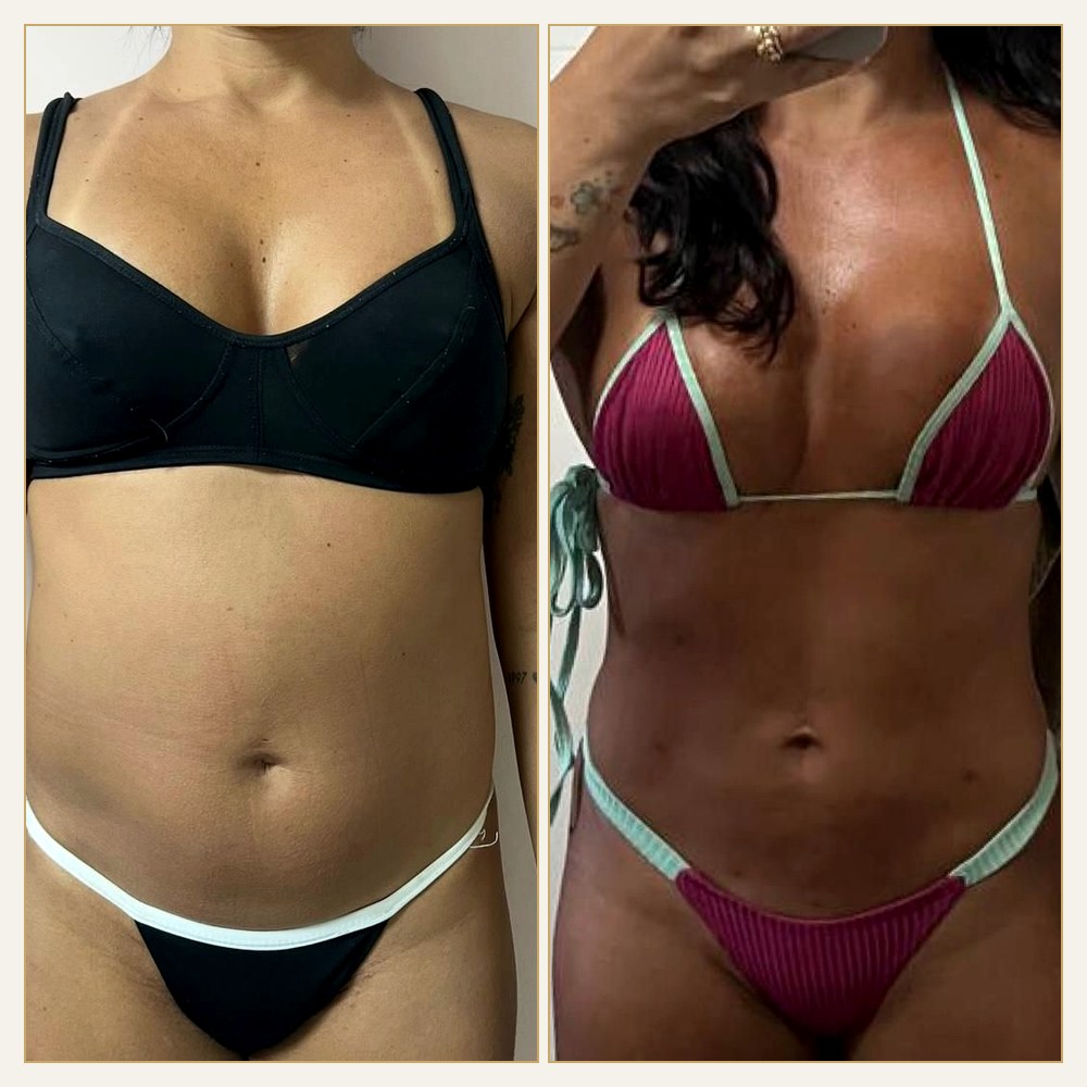 Antes & Depois
